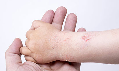 Gói xét nghiệm 6 loại giun sán